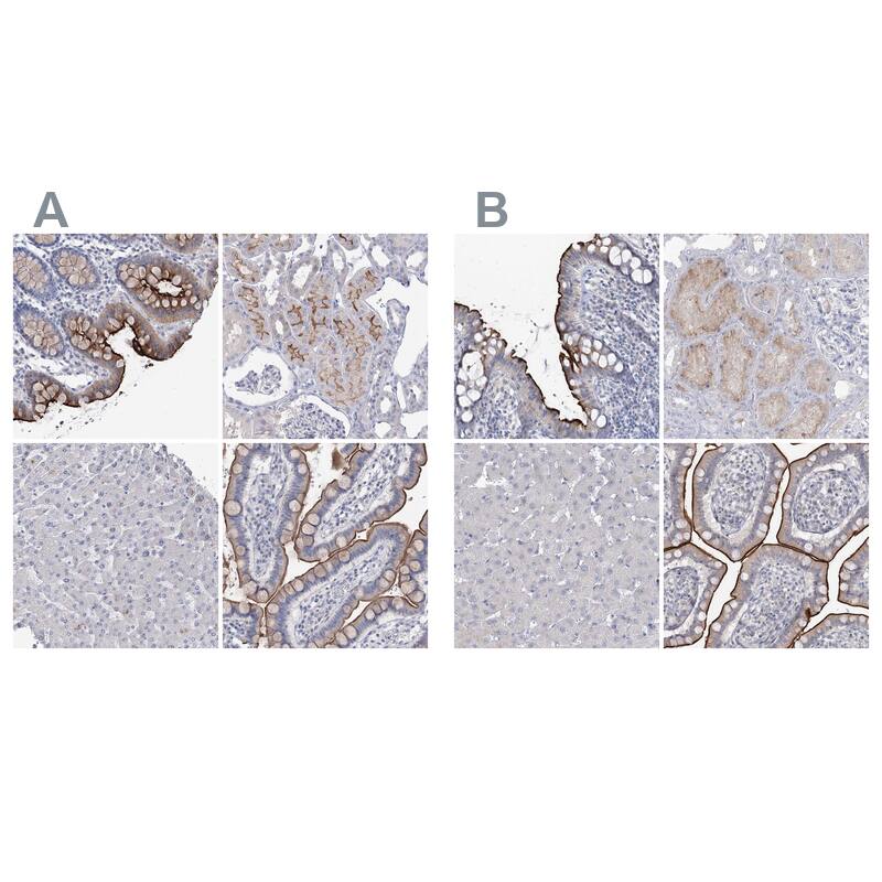 <b>Orthogonal Strategies Validation. </b>Staining of human colon, kidney, liver and small intestine HPA036493 (A) shows similar protein distribution across tissues to independent antibody HPA036669 (B).