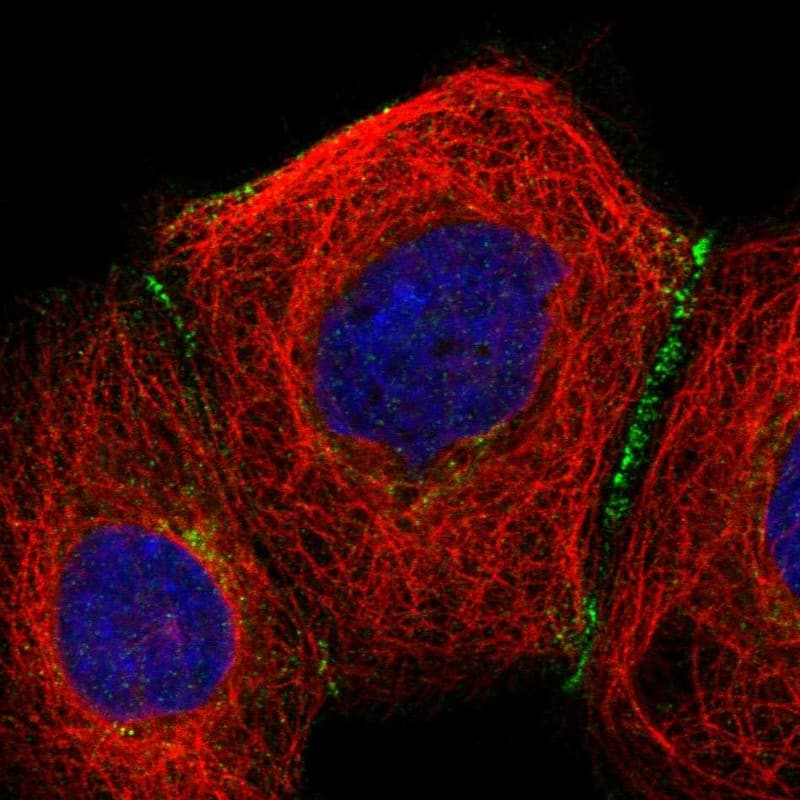 Staining of human cell line A-431 shows localization to cell junctions.