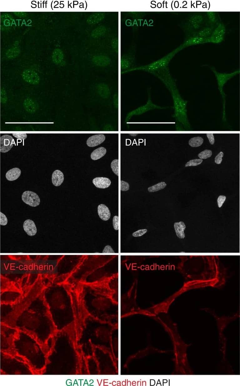 GATA2 regulation by matrix stiffness in LECs. a, b qRT-PCR analysis of GATA2 in human LECs (a) and primary mouse LECs (b) grown on soft (0.2 kPa) or stiff (25 kPa) matrix. n = 3 experiments, mean +/- s.e.m. p value, one-sample t-test. c Immunofluorescence of human LECs grown on stiff and soft matrix using antibodies against GATA2 (green) and VE-cadherin (red), and for DAPI to show nuclei (grey). LECs grown on soft matrix exhibit an overall higher expression of GATA2 as indicated by higher immunofluorescence intensity in both the nucleus and cytoplasm and have an elongated shape and a distorted nucleus. d Quantification of nuclear and cytoplasmic GATA2 protein in human LECs grown on soft (0.2 kPa) or stiff (25 kPa) matrix. Data represent mean pixel intensity (n = 8 images with 8–24 cells per image (soft), and n = 8 images with 21–37 cells per image (stiff) from 3 experiments) +/- s.e.m. p value, unpaired Student’s t-test. Scale bars: 50 um Image collected and cropped by CiteAb from the following open publication (//pubmed.ncbi.nlm.nih.gov/29666442), licensed under a CC-BY license. Not internally tested by Novus Biologicals.