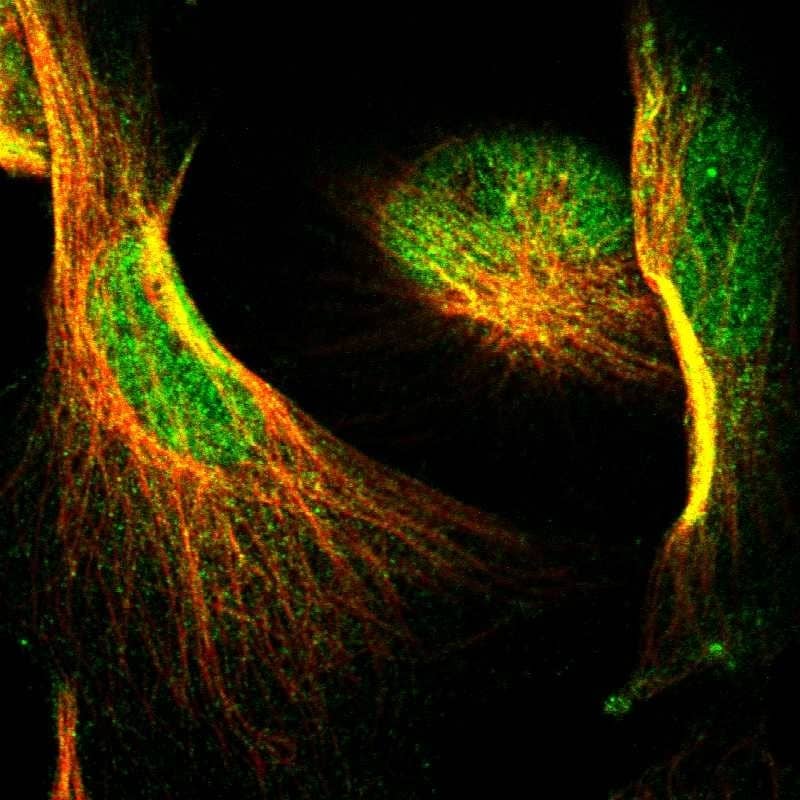 Staining of human cell line U-251 MG shows localization to nucleoplasm & cytosol.