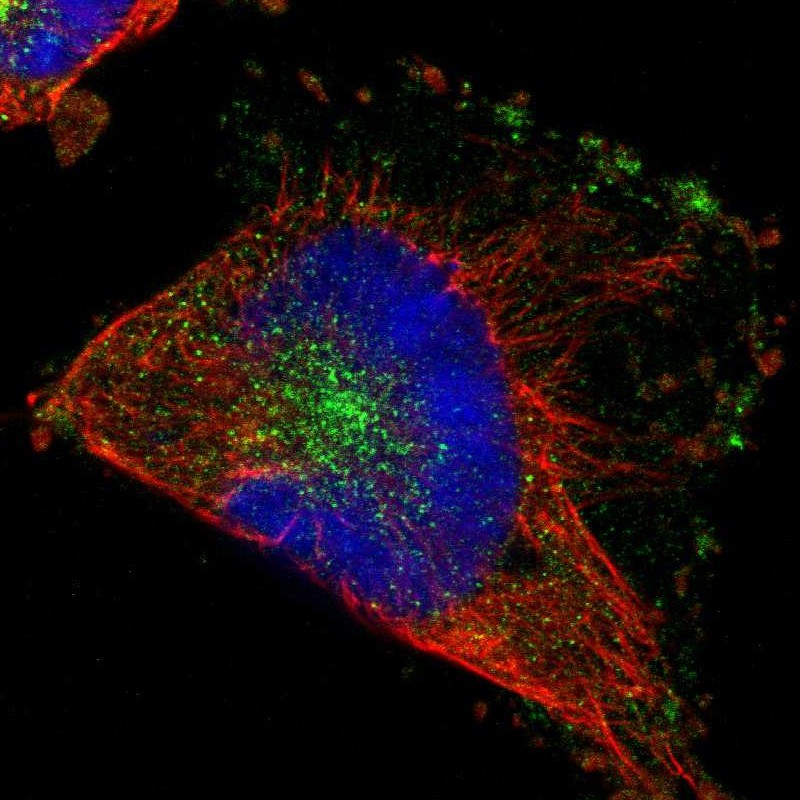 Staining of human cell line U-251 MG shows localization to vesicles.