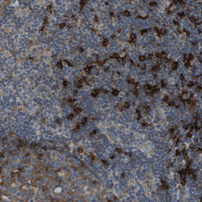Staining of human tonsil shows strong cytoplasmic positivity.