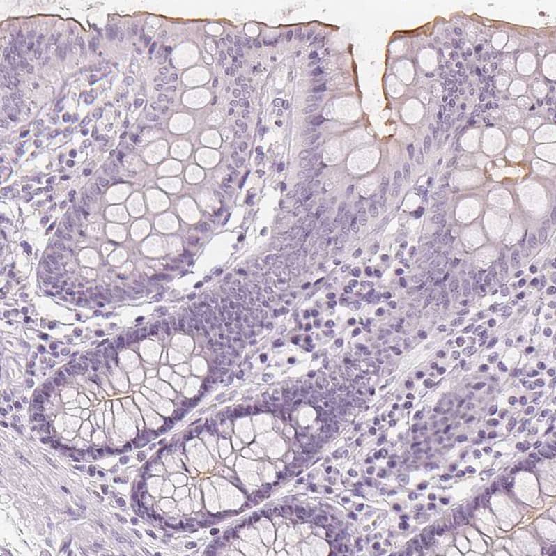 Immunohistochemistry-Paraffin MUC12 Antibody - BSA Free