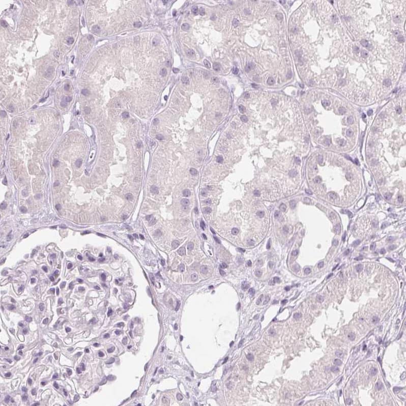 Immunohistochemistry-Paraffin MUC12 Antibody - BSA Free