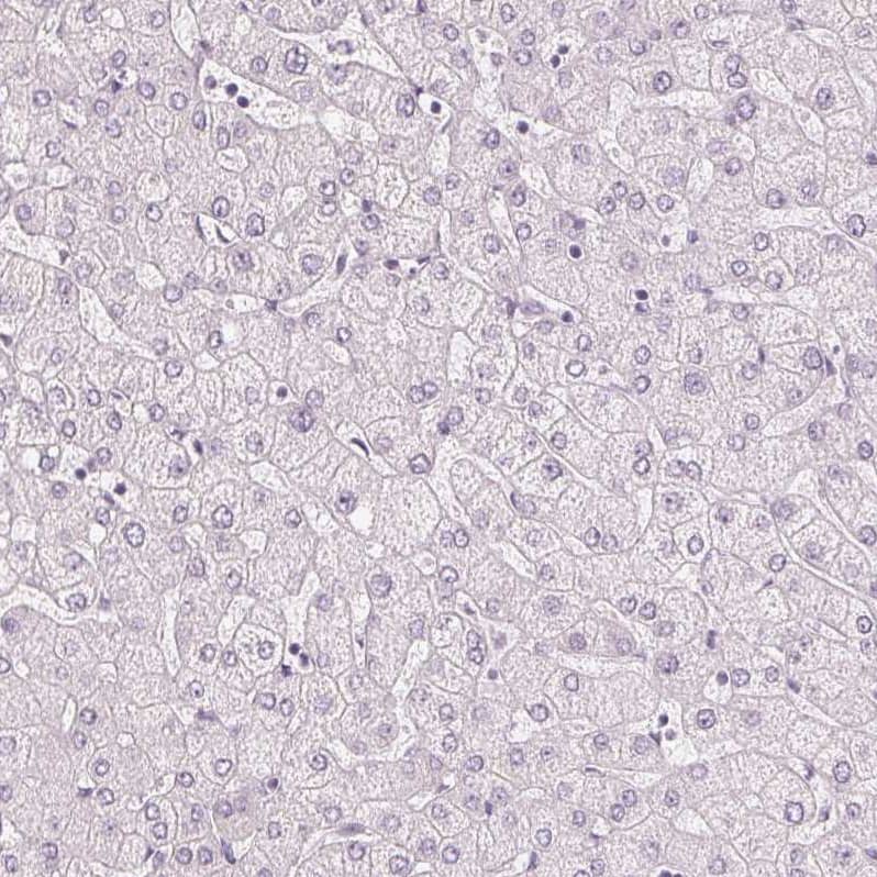 Immunohistochemistry-Paraffin MUC12 Antibody - BSA Free