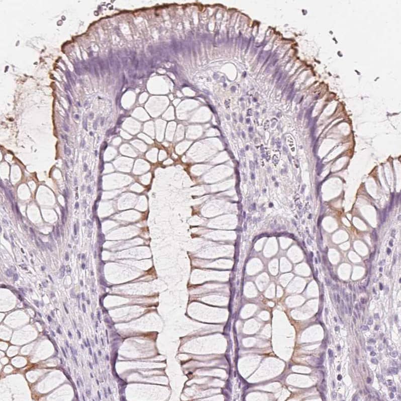 Immunohistochemistry-Paraffin MUC12 Antibody - BSA Free
