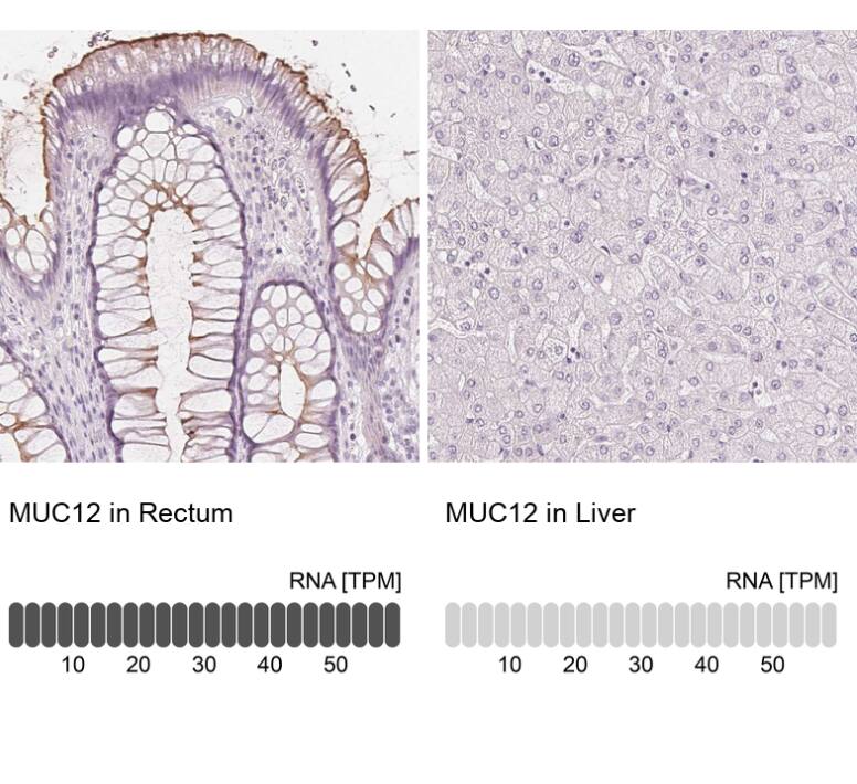 <b>Orthogonal Strategies Validation. </b>Analysis in human rectum and liver tissues using NBP1-82607 antibody. Corresponding MUC12 RNA-seq data are presented for the same tissues.