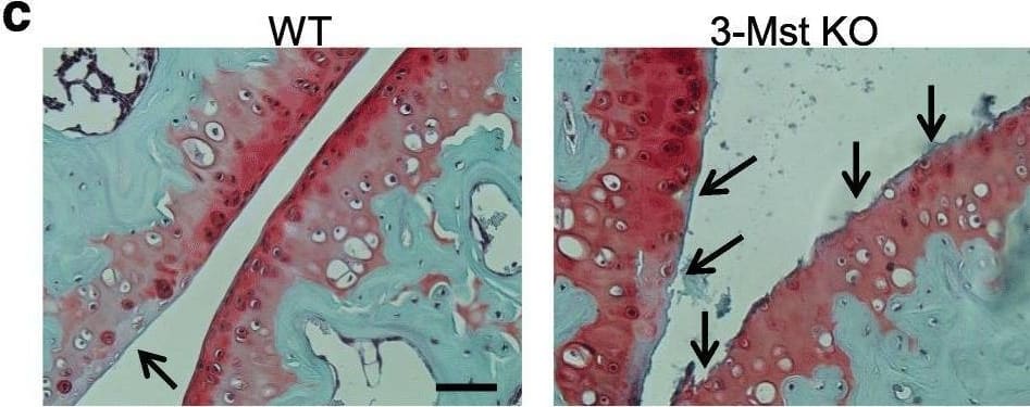 3-MST deficiency exacerbates joint calcification and cartilage damage in experimental OA. a Representative immunohistochemical analysis of 3-MST expression in the knee section from sham-operated and MNX WT mice. A knee section from a sham-operated 3-Mst KO mouse was used to prove the specificity of the 3-MST antibody. Scale bars 150 μm. b Representative micro-CT scan images of WT and 3-MST KO MNX murine knee joints two months after surgery. White arrows show calcified periarticular deposits in MNX WT knees and their exacerbation in 3-MST KO mice. Graphs show CTAnalyzer quantitative analysis of new formation volume (mm3) and new formation crystal content (μg) in WT and 3-MST KO MNX knees. c Representative histologies of WT and 3-MST KO MNX knees, stained with Safranin-O. Black arrows show increased cartilage degradation in 3-MST KO mice. Scale bars 150 μm. Graphs show femoral scoring of cartilage damage and Safranin-O loss, accordingly to OARSI method. d Thiosulfate measurement in the serum of WT and 3-MST KO mice. Mice number WT n = 8, 3-MST KO n = 8 Image collected and cropped by CiteAb from the following open publication (//pubmed.ncbi.nlm.nih.gov/32183900), licensed under a CC-BY license. Not internally tested by Novus Biologicals.