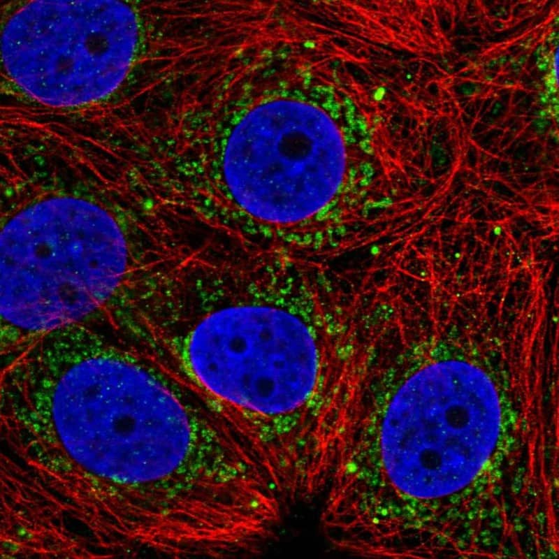 Staining of human cell line MCF7 shows localization to mitochondria.
