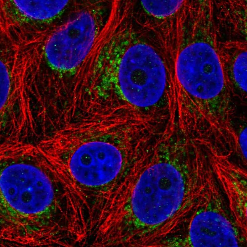 Staining of human cell line MCF7 shows localization to mitochondria.