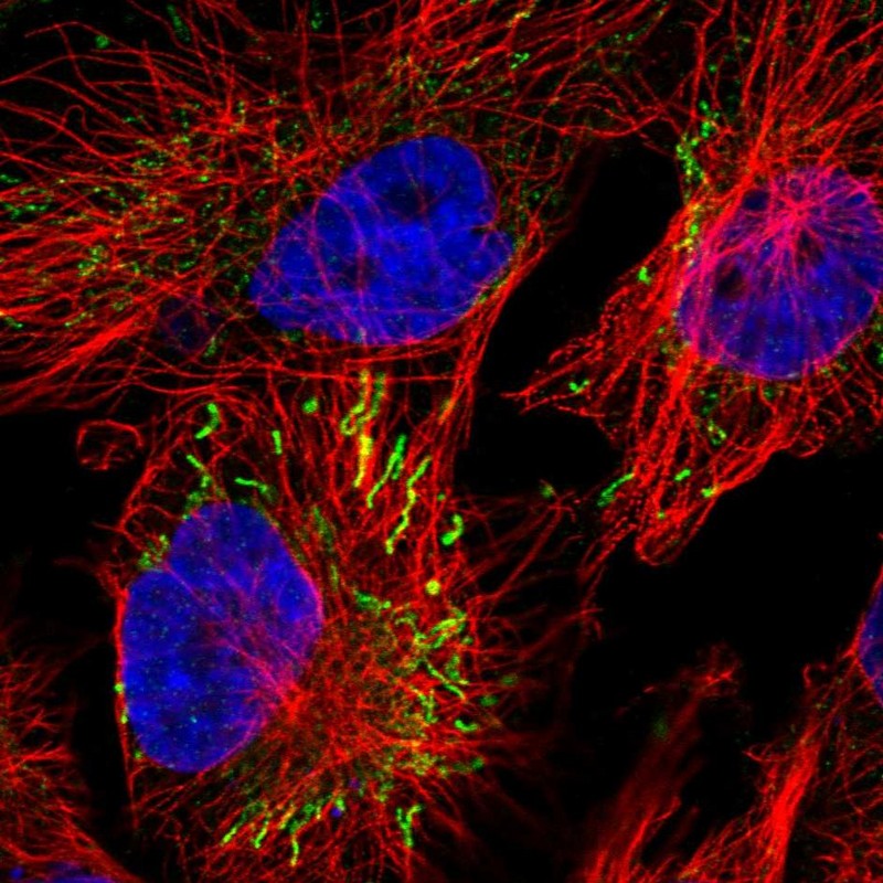 Staining of human cell line U-251 MG shows localization to mitochondria.