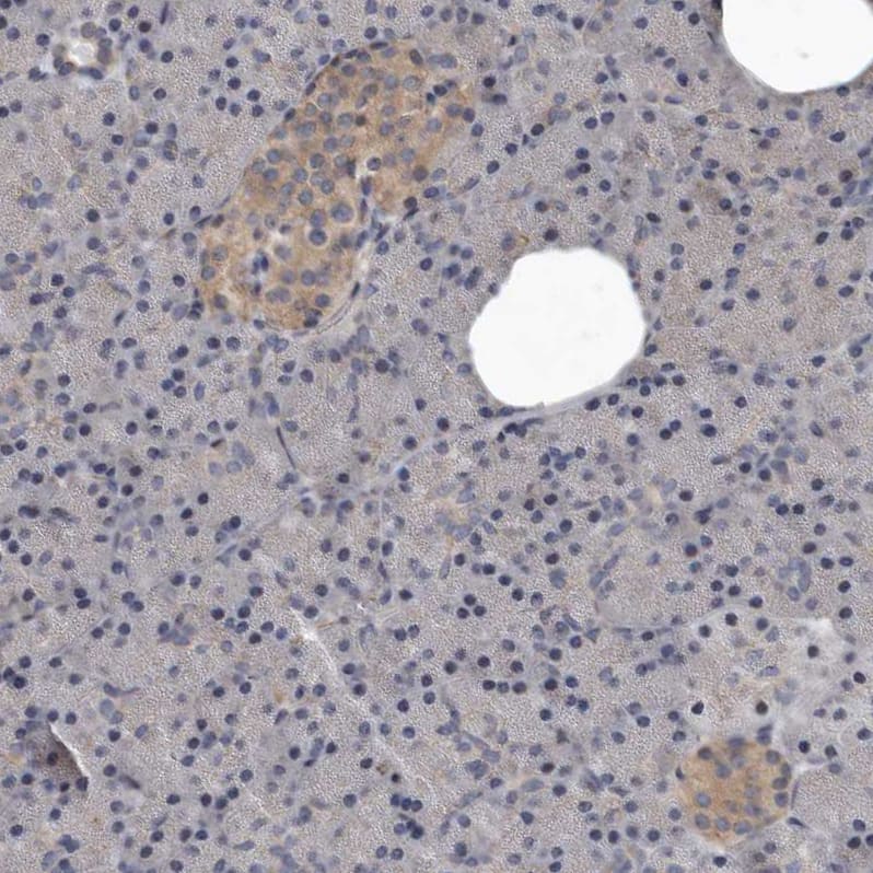 Staining of human pancreas shows weak cytoplasmic positivity in islets of Langerhans.