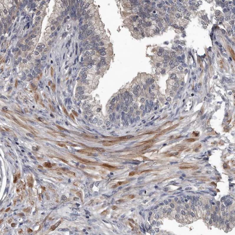 Staining of human prostate shows moderate cytoplasmic positivity in smooth muscle cells.