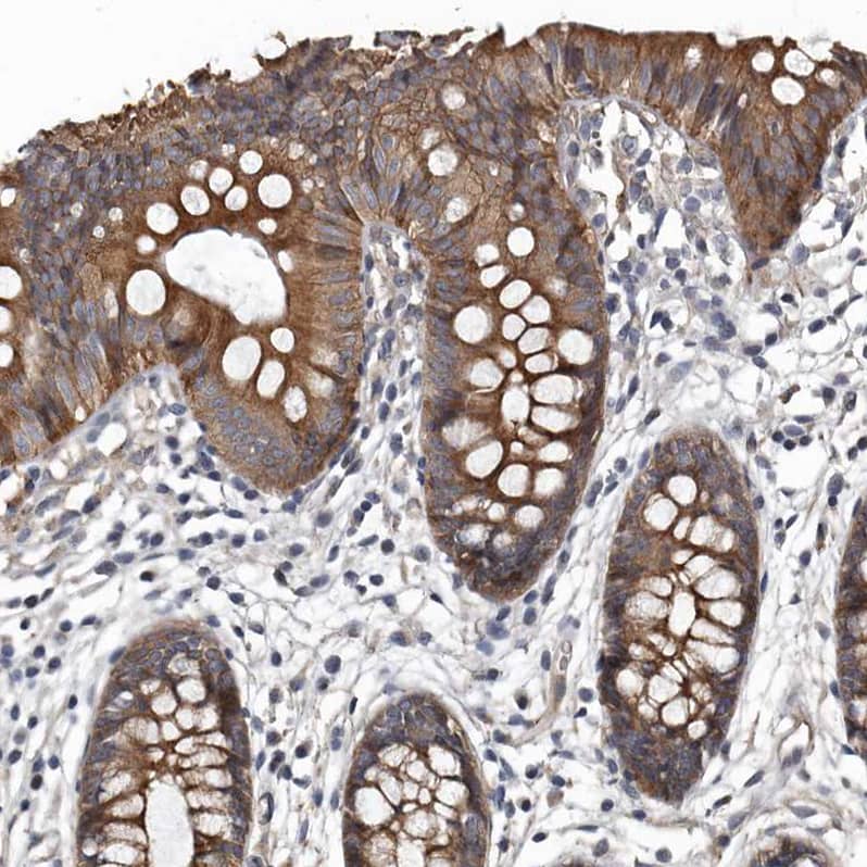 Staining of human colon shows moderate  cytoplasmic positivity in glandular cells.