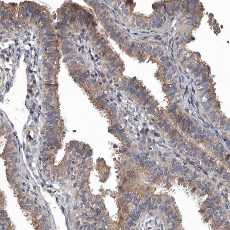 Staining of human fallopian tube shows moderate cytoplasmic/membranous positivity in glandular cells.