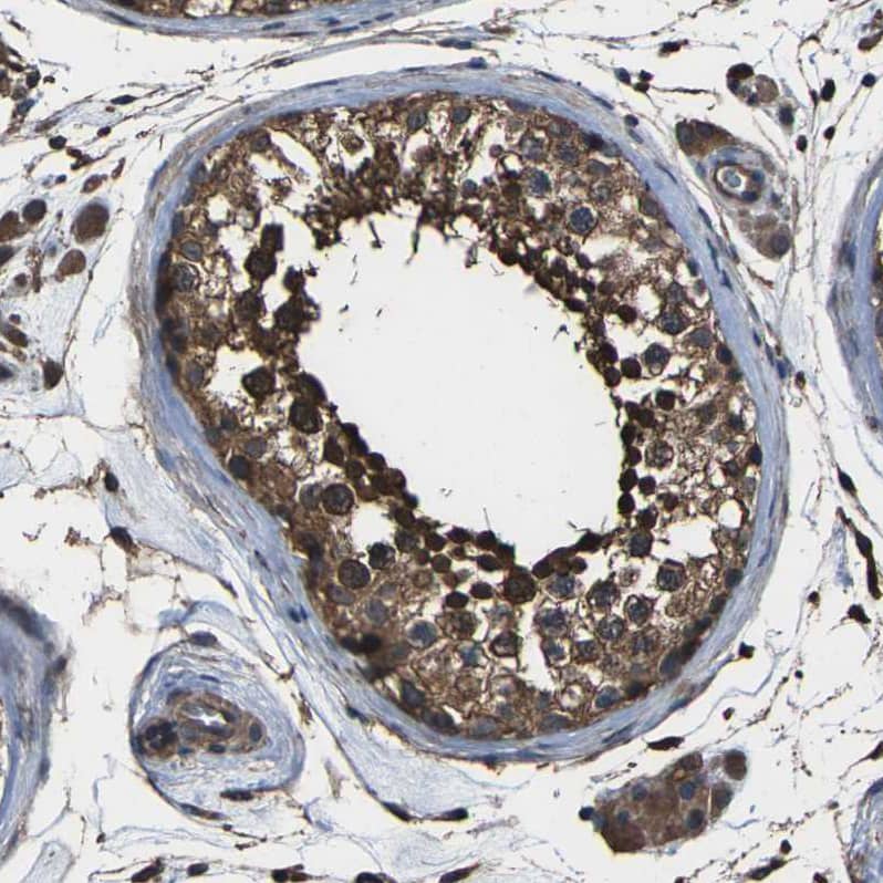 Staining of human testis shows moderate to strong cytoplasmic positivity in cells in seminiferous ducts.