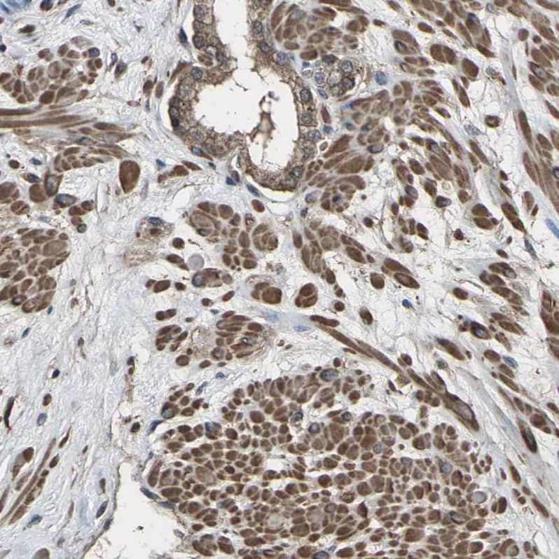 Staining of human prostate shows moderate to strong cytoplasmic positivity in smooth muscle cells.