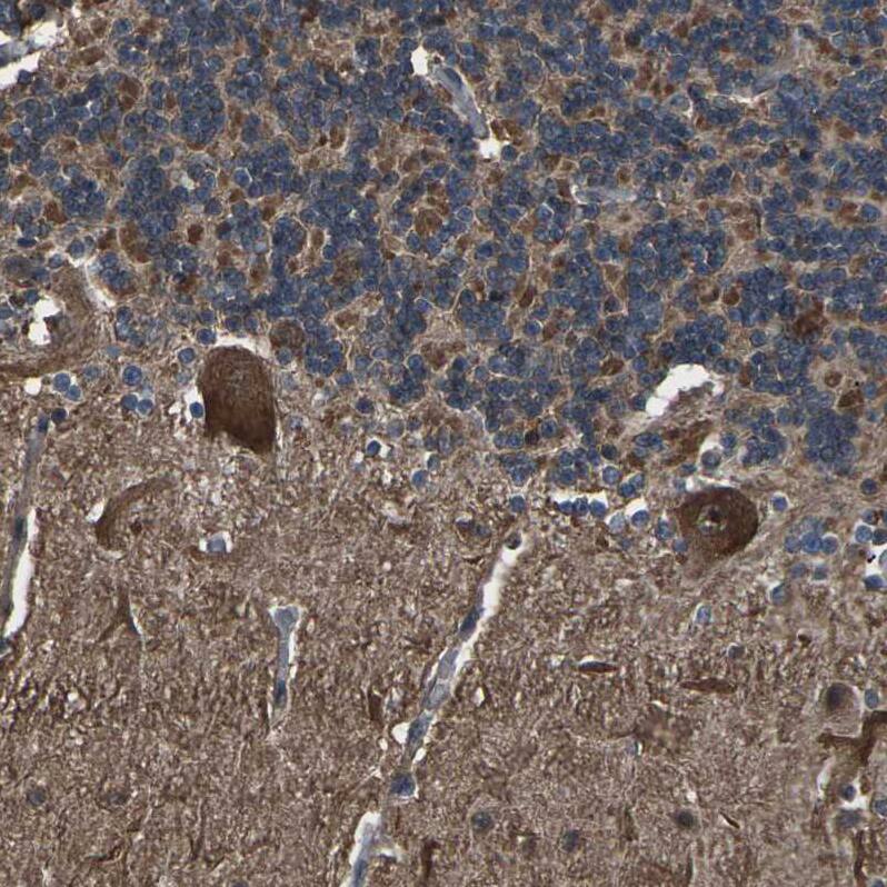 Staining of human cerebellum shows moderate to strong cytoplasmic positivity in Purkinje cells.