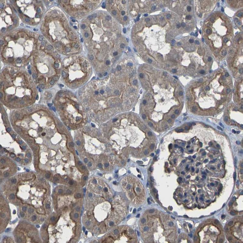 Staining of human kidney shows moderate to strong cytoplasmic positivity in cells in tubules.