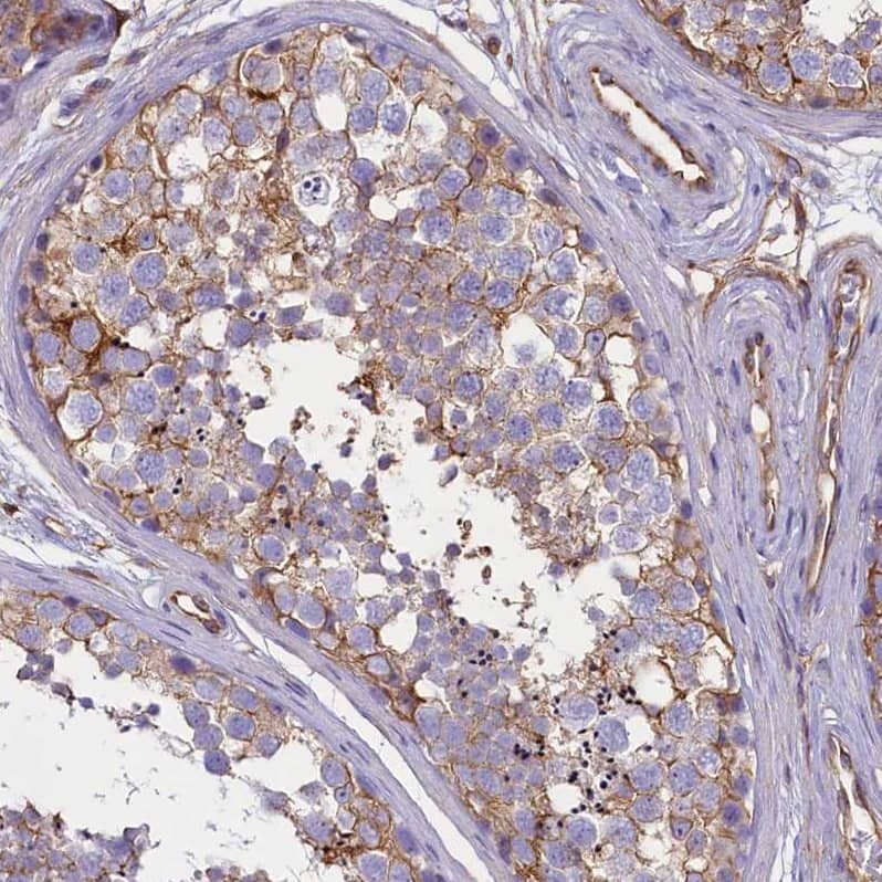 Staining of human testis shows strong membranous positivity in cells in seminiferous ducts.