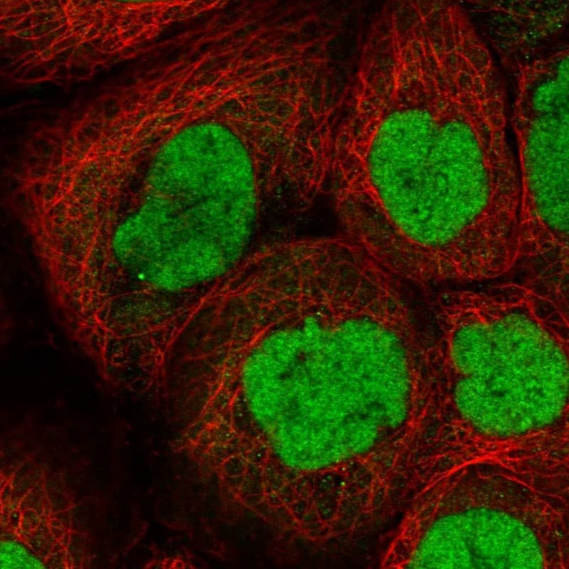 Staining of human cell line A-431 shows localization to nucleoplasm.