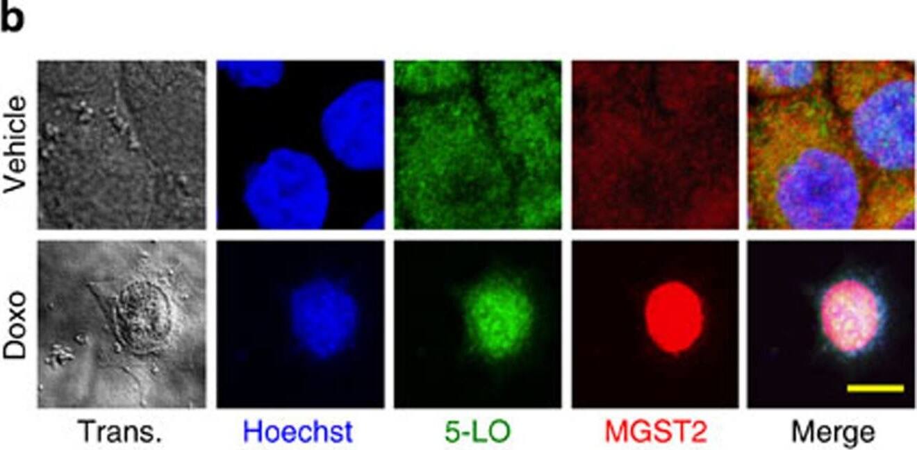 Chemotherapy-activated MGST2-LTC4 pathway triggers NOX4-mediated oxidative DNA damage and cell death.(a) Immunoblot of the indicated proteins in extracts of WISH cells treated with doxorubicin (5 μM) or 5-FU (20 μg ml−1) for the indicated times. (b) Immunostain of 5-LO and MGST2 in WISH cells treated with vehicle or doxorubicin (Doxo, 5 μM). Nuclei were counterstained with Hoechst. Trans. is transmission light microscopy. All image channels except the transmission light microscopy were merged. Bar, 5 μm. (c,d) Immunostain of LTC4 in WISH cells pre-treated with vehicle, siControl or siMgst2, followed by vehicle or doxorubicin (1 μM, 36 h). Nuclei were counterstained with Hoechst. Bar, 20 μm. n=3, ****P<0.0001, ***P<0.001. (e,f) Immunostain of NOX4 in cells treated with vehicle or doxorubicin. Bar, 20 μm. n=3, ***P<0.001. (g,h) ROS detection with DCFH-DA in cells treated with vehicle or doxorubicin (2.5 μM, 48 h) in the absence or presence of the indicated inhibitors. Bar, 50 μm. n=6, ***P<0.0001. (i,j) Immunostain of the dsDNA break marker  gamma -H2AX in cells treated with doxorubicin (5 μM, 48 h) in the absence or presence of the indicated LTC4 receptor antagonists. Bar, 20 μm. n=3–4, ***P<0.0001. (k,l) Survival of primary WT and Mgst2-deficient MEFs, treated with vehicle or doxorubicin (10 μM) and then stained with crystal violet. Bar, 50 μm. Viabilities of vehicle-treated WT and and KO MEFs were taken as 100% survival, respectively. n=3, ***P<0.005. Images a and b are representatives of three replicates. Values in d,f,h,j and l represent the mean+/-s.d. Statistical significance was determined using one-way ANOVA. Image collected and cropped by CiteAb from the following open publication (//pubmed.ncbi.nlm.nih.gov/26656251), licensed under a CC-BY license. Not internally tested by Novus Biologicals.