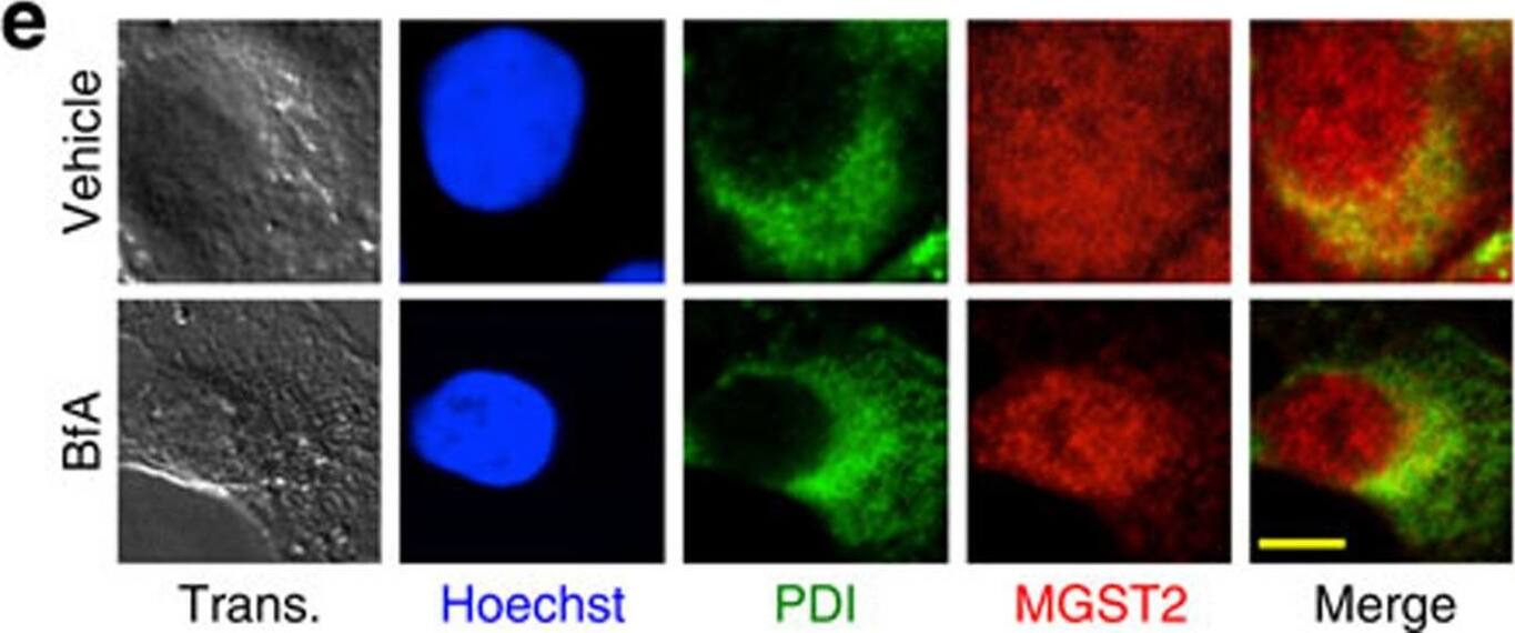 ER stress triggers expression and nuclear localization of proteins involved in LTC4 biosynthesis.(a) Immunoblot of proteins expressed in WISH cells at different times after induction of ER stress with BfA. Blots are representatives of three replicates. (b–e) Immunostain of the indicated proteins following treatment of WISH cells with vehicle or BfA. Trans. is transmission light microscopy. Nuclei were counterstained with Hoechst 33258 (Hoechst). Shown are merges of 5-LO and MGST2; 5-LO, Hoechst and cPLA2; Hoechst, 5-LO and FLAP; and MGST2 and the ER marker protein disulfide isomerase (PDI). Bars, 5 μm. (f) Quantification of per cent co-localization of FLAP and MGST2 with 5-LO, as determined by analysis of confocal microscopy images. n=6, P<0.0001 for both pairs. (g) Quantification of per cent nuclear localization of the indicated proteins as determined by analysis of confocal microscopy of the images shown in panels b–e. n≥6, P<0.0001 for all samples. Values in f and g represent the mean+/-s.d. Statistical significance was determined using one-way analysis of variance (ANOVA). Image collected and cropped by CiteAb from the following open publication (//pubmed.ncbi.nlm.nih.gov/26656251), licensed under a CC-BY license. Not internally tested by Novus Biologicals.