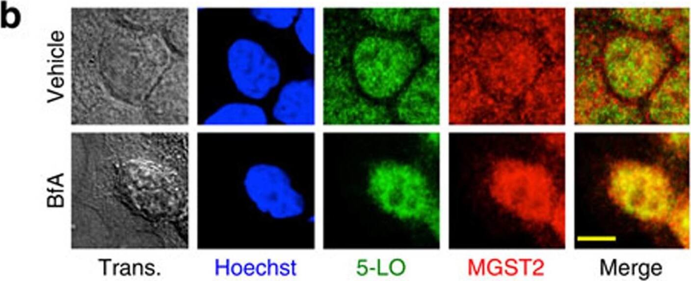 ER stress triggers expression and nuclear localization of proteins involved in LTC4 biosynthesis.(a) Immunoblot of proteins expressed in WISH cells at different times after induction of ER stress with BfA. Blots are representatives of three replicates. (b–e) Immunostain of the indicated proteins following treatment of WISH cells with vehicle or BfA. Trans. is transmission light microscopy. Nuclei were counterstained with Hoechst 33258 (Hoechst). Shown are merges of 5-LO and MGST2; 5-LO, Hoechst and cPLA2; Hoechst, 5-LO and FLAP; and MGST2 and the ER marker protein disulfide isomerase (PDI). Bars, 5 μm. (f) Quantification of per cent co-localization of FLAP and MGST2 with 5-LO, as determined by analysis of confocal microscopy images. n=6, P<0.0001 for both pairs. (g) Quantification of per cent nuclear localization of the indicated proteins as determined by analysis of confocal microscopy of the images shown in panels b–e. n≥6, P<0.0001 for all samples. Values in f and g represent the mean+/-s.d. Statistical significance was determined using one-way analysis of variance (ANOVA). Image collected and cropped by CiteAb from the following open publication (//pubmed.ncbi.nlm.nih.gov/26656251), licensed under a CC-BY license. Not internally tested by Novus Biologicals.