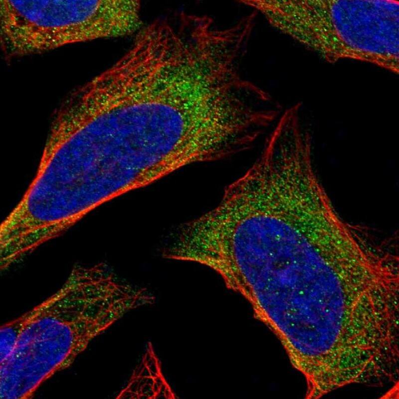Staining of human cell line U-2 OS shows localization to cytosol.