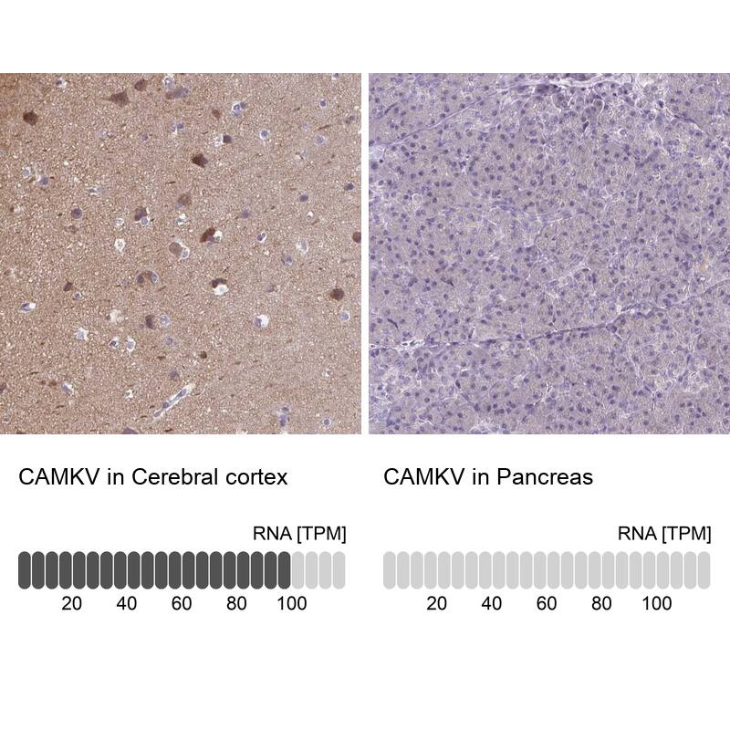 Immunohistochemistry-Paraffin CaMKV Antibody - BSA Free