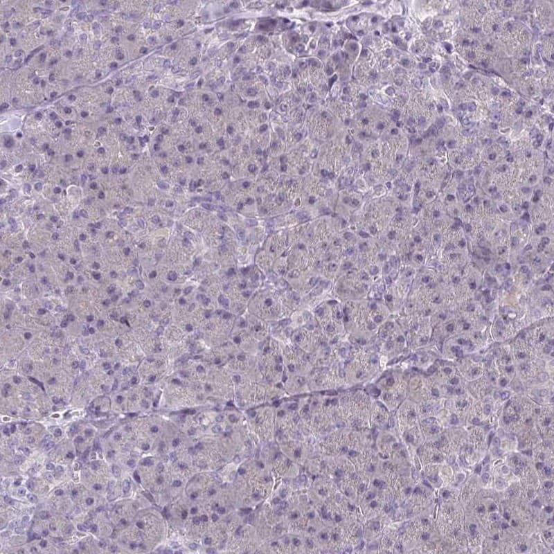 Immunohistochemistry-Paraffin CaMKV Antibody - BSA Free