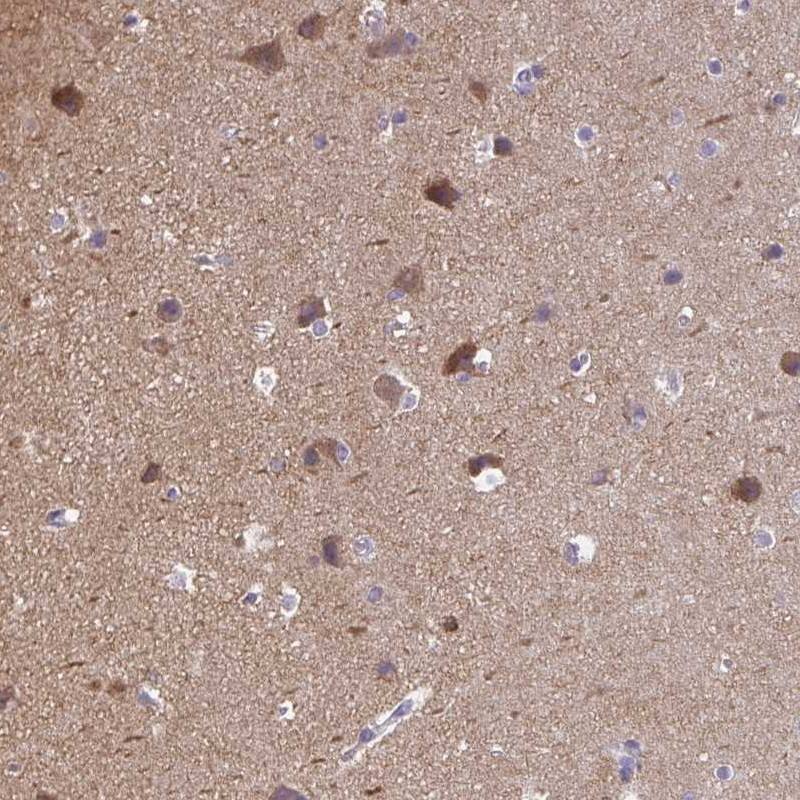 Immunohistochemistry-Paraffin CaMKV Antibody - BSA Free