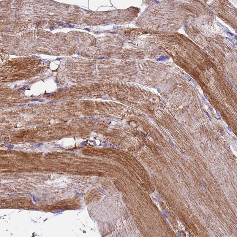 Immunohistochemistry-Paraffin NDUFA8 Antibody - BSA Free