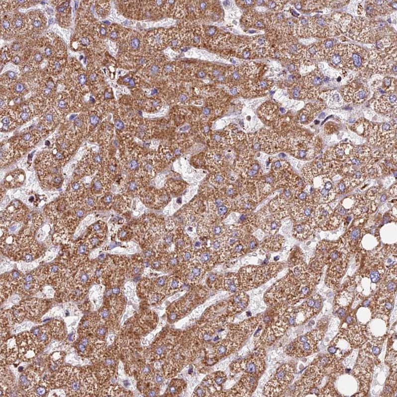 Staining of human liver shows strong granular cytoplasmic positivity in hepatocytes.