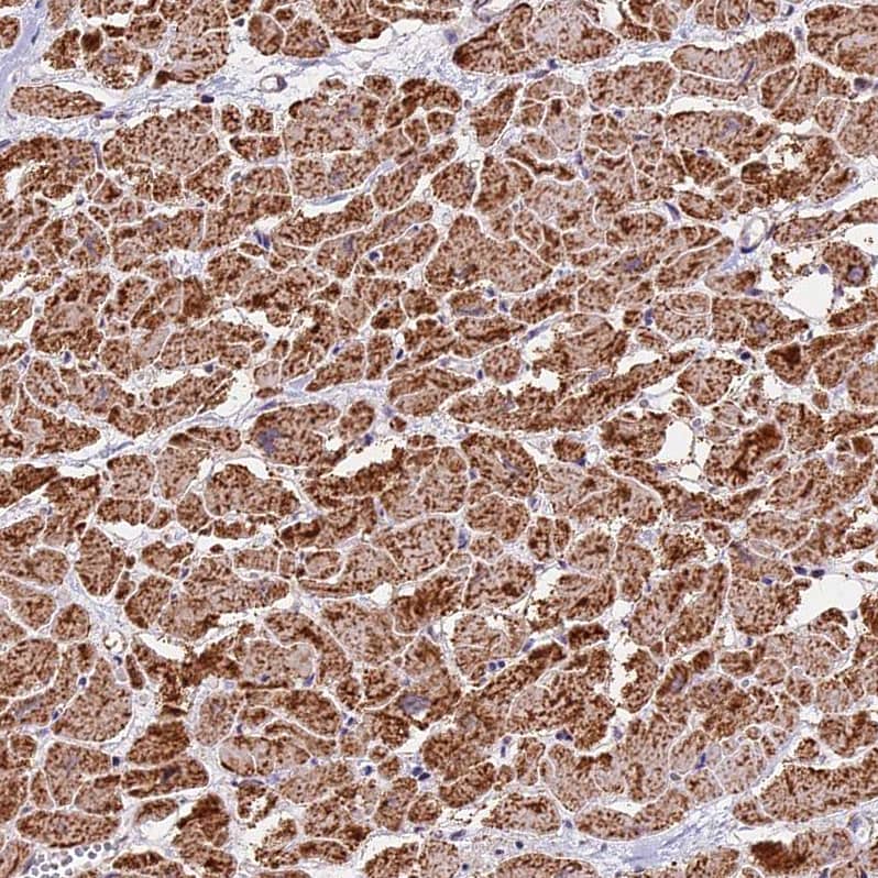 Staining of human heart muscle shows strong granular cytoplasmic positivity in cardiomyocytes.