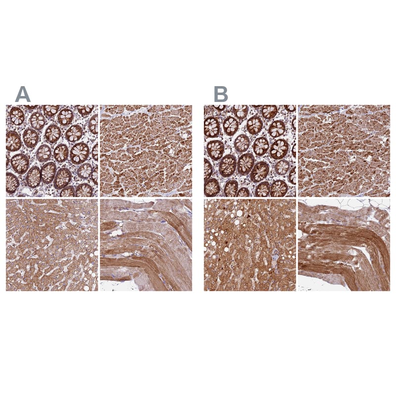 <b>Orthogonal Strategies Validation. </b>Staining of human gastrointestinal, heart muscle, liver and skeletal muscle HPA041510 (A) shows similar protein distribution across tissues to independent antibody HPA041600 (B).