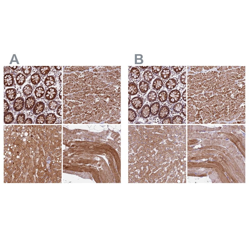 <b>Independent Antibodies Validation. </b>Staining of human gastrointestinal, heart muscle, liver and skeletal muscle using NBP1-82662 (A) shows similar protein distribution across tissues to independent antibody NBP1-82661 (B).