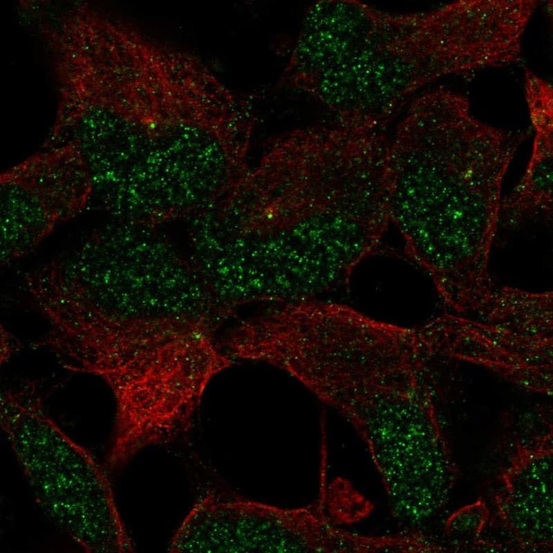 Staining of human cell line AF22 shows localization to nucleus & centrosome.