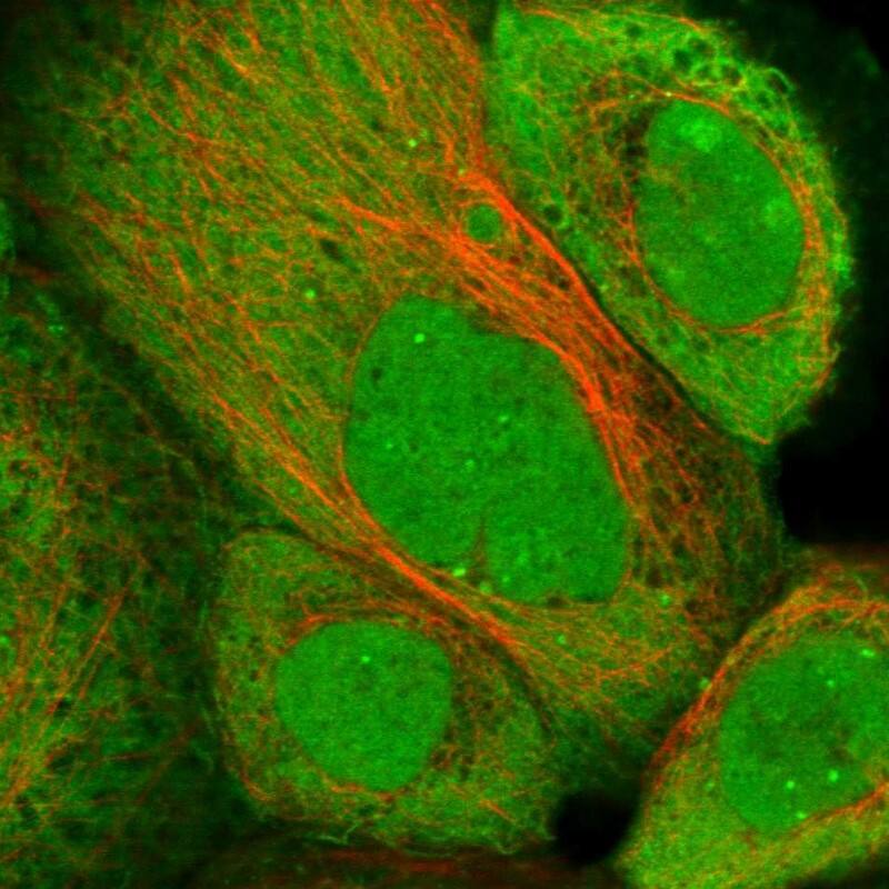 Immunocytochemistry/ Immunofluorescence ZNF276 Antibody - BSA Free