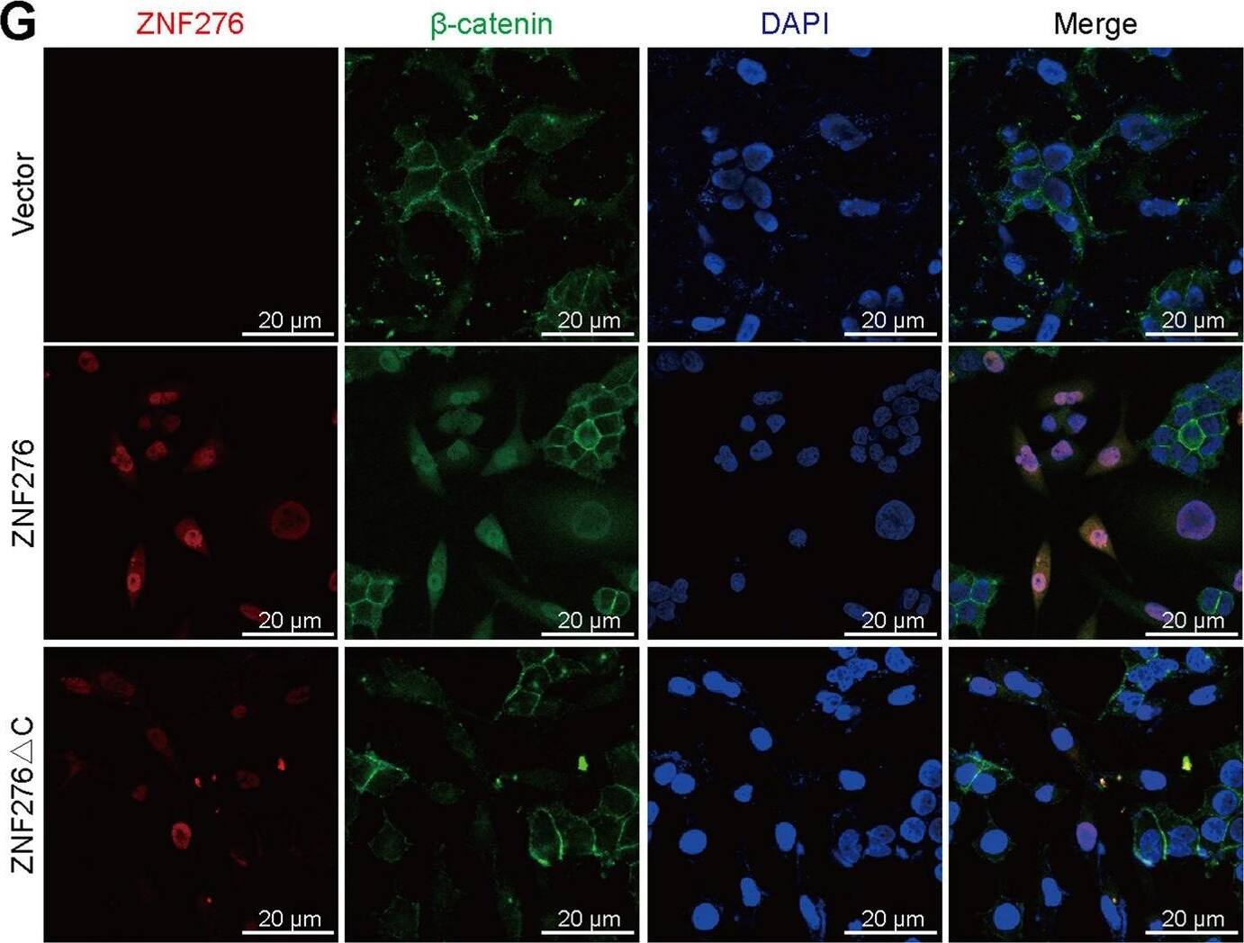 ZNF276 activates the Wnt/ beta -catenin signaling by regulation of CYP1B1.A, C Western blotting (A) and RT-qPCR (C) analysis revealed that silencing of CYP1B1 inhibited the expression of c-Myc and Cyclin D1 enhanced by ZNF276 overexpression in MDA-MB-231 cells. B, D Effects of ZNF276 knockdown and CYP1B1 overexpression on c-Myc and Cyclin D1 expression were analyzed in UACC-812 cells by western blotting (B) and RT-qPCR (D). E, F ZNF276 lacking C2H2 domain inhibited the TOP Flash activity enhanced by the intact ZNF276 with wnt3a activation in MDA-MB-231 (E) and UACC-812 (F) cells. G Endogenous  beta -catenin expression and distribution was observed by immunofluorescence in MDA-MB-231 cells transfected with intact ZNF276 or ZNF276 lacking C2H2 domain plasmid. Nuc nuclear. Bar = 20 um. *p < 0.05; **p < 0.01; ***p < 0.001. Image collected and cropped by CiteAb from the following open publication (//pubmed.ncbi.nlm.nih.gov/36085146), licensed under a CC-BY license. Not internally tested by Novus Biologicals.