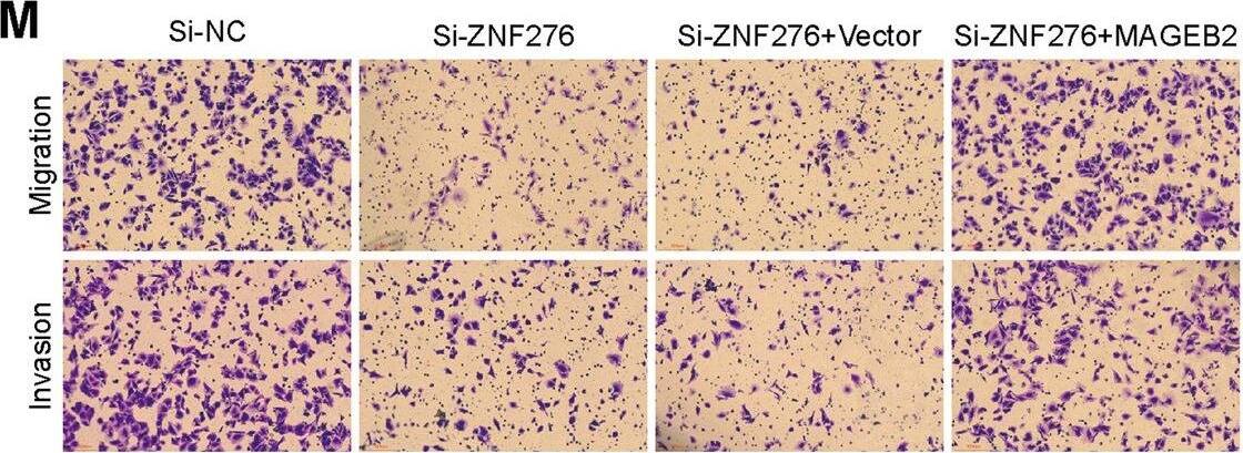 ZNF276 activates Wnt/ beta -catenin signaling through recruitment of MAGEB2 to regulate CYP1B1 transcription.A GO analysis of the potential ZNF276-interacted proteins. B KEGG analysis of the potential ZNF276-interacted proteins. C, D Both forward (C) and reverse (D) co-IP analysis affirmed the interaction between ZNF276 and MAGEB2. E ChIP-PCR analysis of ZNF276 binding ability at the CYP1B1 promoter affected by MAGEB2 overexpression. F, G The luciferase activity of CYP1B1 promoter decreased by ZNF276 silencing was further enhanced by the expression of MAGEB2 in 293T and MCF-7. H, I RT-qPCR (H) and western blot (I) analysis confirmed the effect of MAGEB2 overexpression in CYP1B1 mRNA and protein expression in MCF-7 cells. J, K The reduced transcriptional activity of CYP1B1 promoter by ZNF276 was partially reversed by MAGEB2. L, M Overexpression of MAGEB2 reversed the decreased cell proliferation, migration and invasion abilities affected by ZNF276 silencing in CCK-8 assay (L), transwell migration (M, up) and transwell invasion (M, down). Image collected and cropped by CiteAb from the following open publication (//pubmed.ncbi.nlm.nih.gov/36085146), licensed under a CC-BY license. Not internally tested by Novus Biologicals.