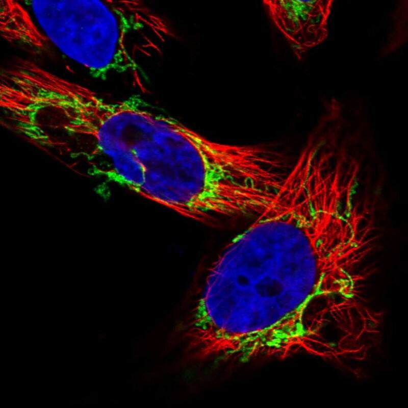 Staining of human cell line U-251 MG shows localization to mitochondria.