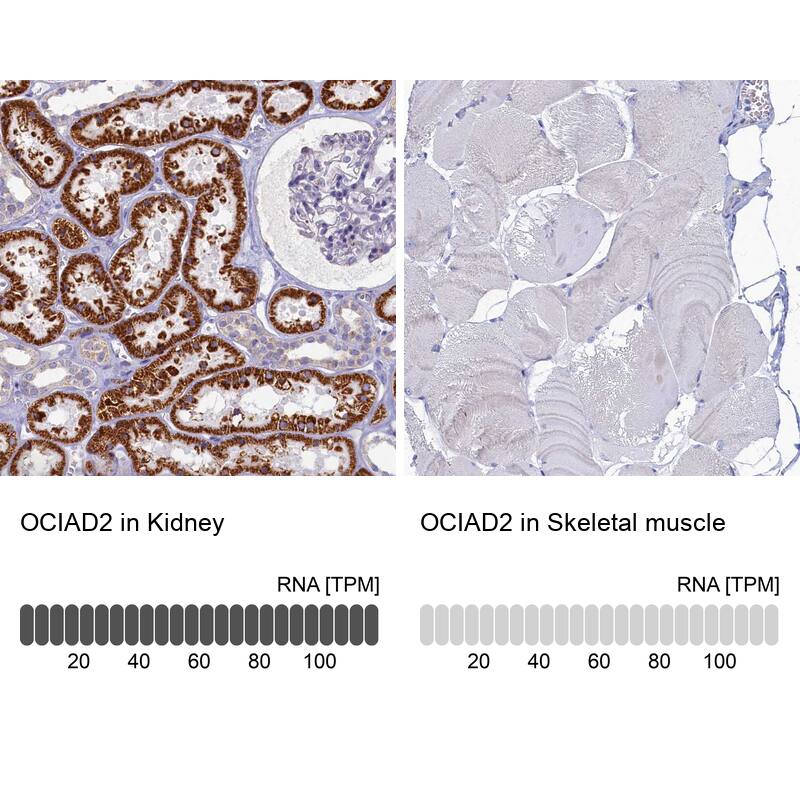<b>Orthogonal Strategies Validation. </b>Analysis in human kidney and skeletal muscle tissues. Corresponding RNA-seq data are presented for the same tissues.