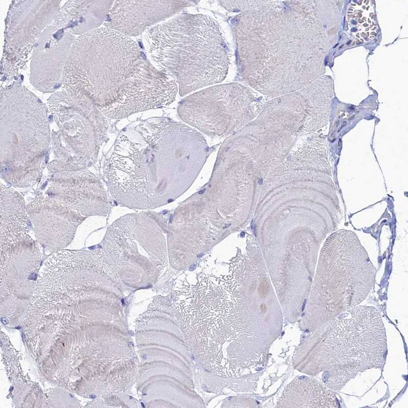 Staining of human skeletal muscle shows no positivity in myocytes as expected.
