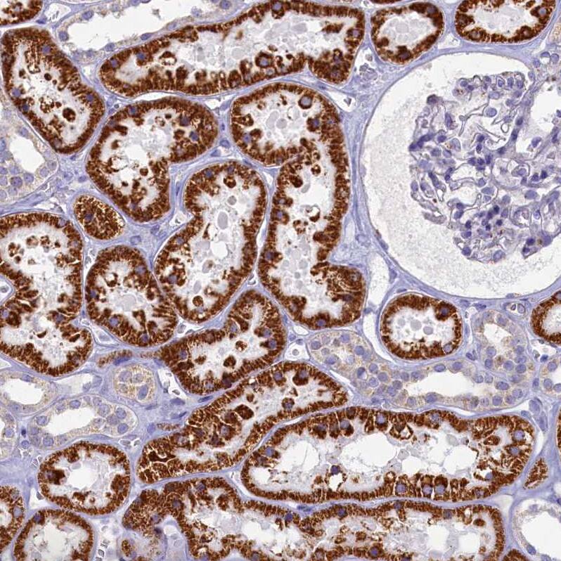 Staining of human kidney shows strong granular cytoplasmic  positivity in cells in tubules.