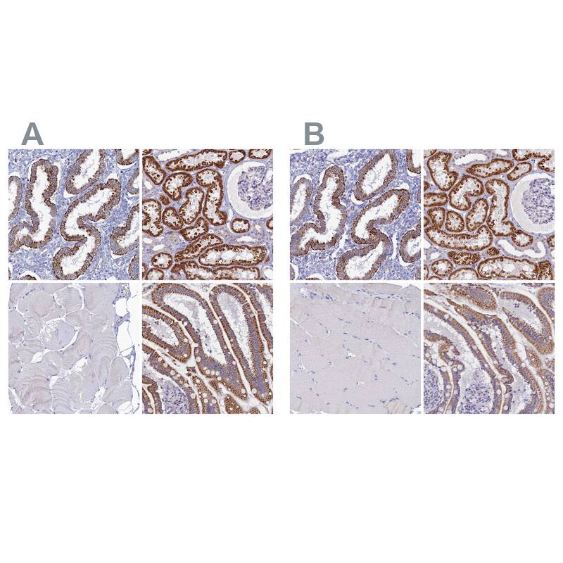 <b>Orthogonal Strategies Validation. </b>Staining of human endometrium, kidney, skeletal muscle and upper gastrointestinal HPA040979 (A) shows similar protein distribution across tissues to independent antibody HPA041090 (B).