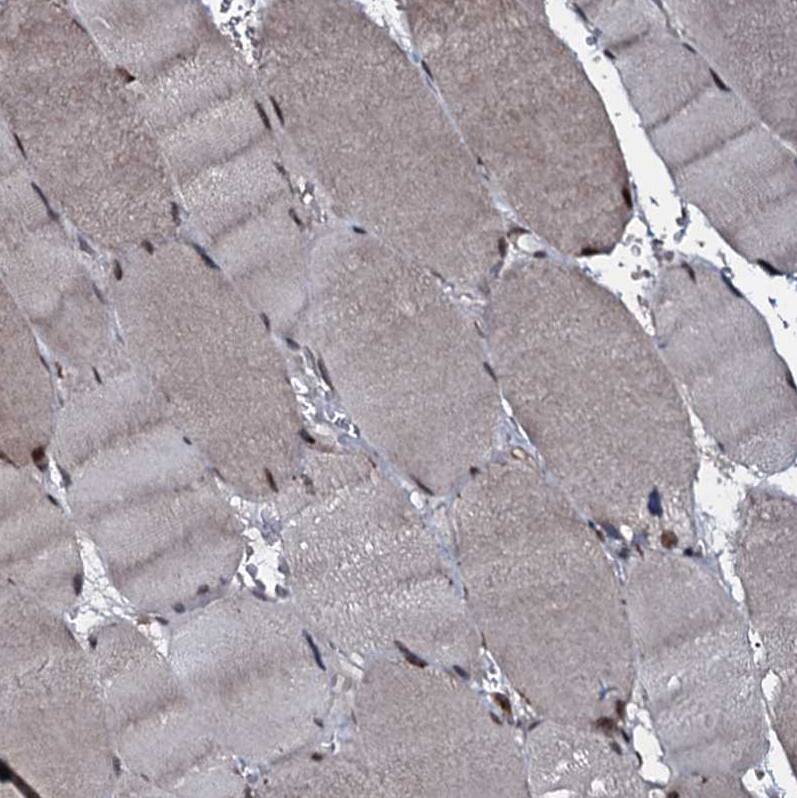 Immunohistochemistry-Paraffin HDDC3 Antibody - BSA Free
