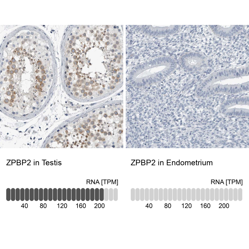 Immunohistochemistry-Paraffin ZPBP2 Antibody - BSA Free