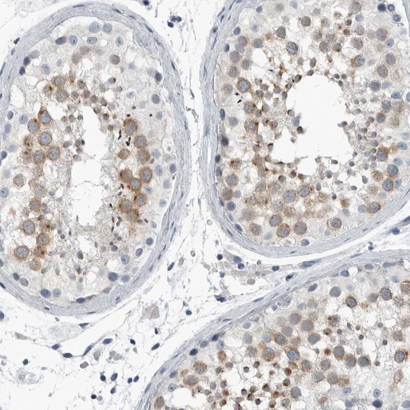 Immunohistochemistry-Paraffin ZPBP2 Antibody - BSA Free