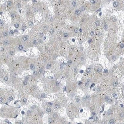 Staining of human liver.